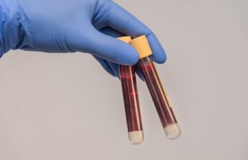 Blodd samples in test tubes